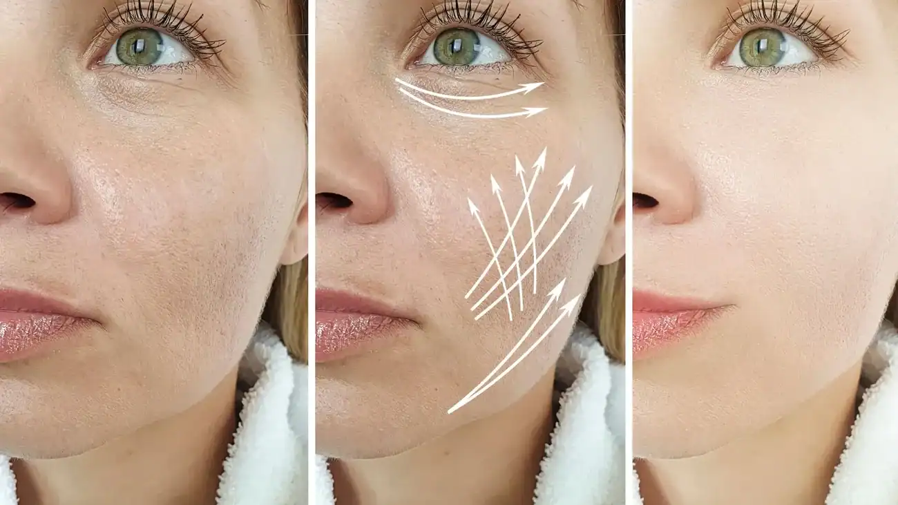 Can One Treatment Really Tackle More Than One Skin Concern Addlestone?