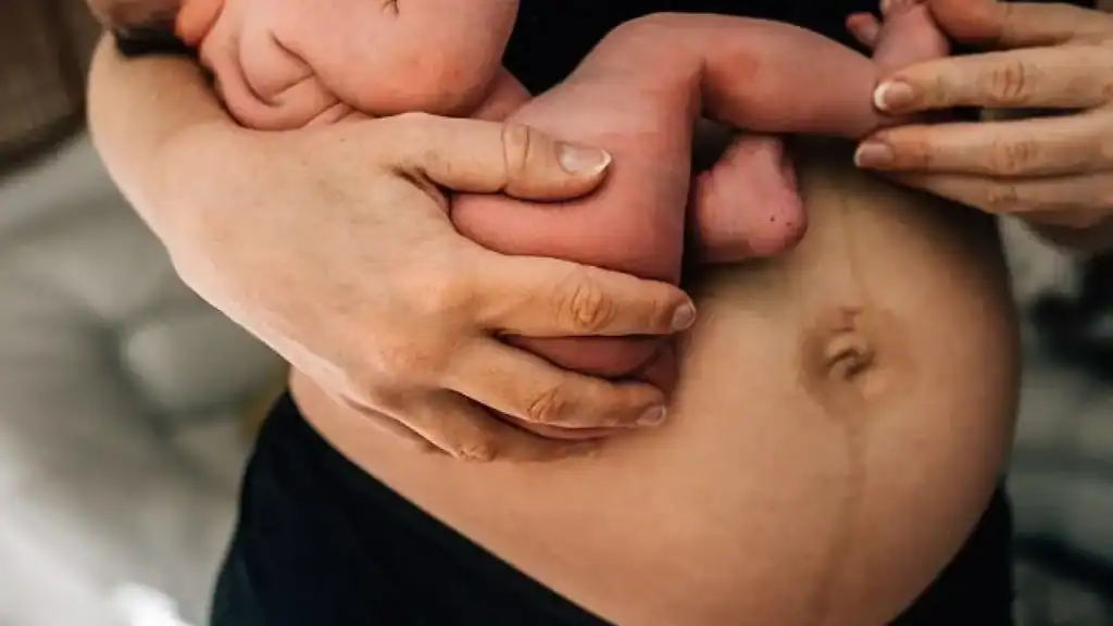 Why Is My Stomach Still Big After Pregnancy Addlestone?